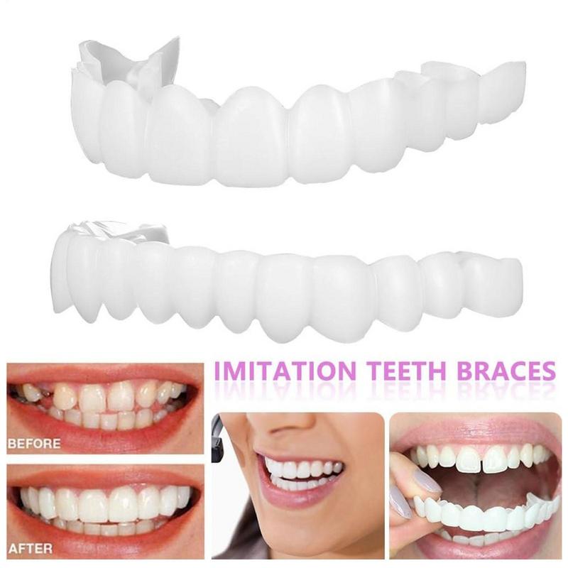 Teeth Whitening Instant - Snap On Teeth Veneers Instant Smile