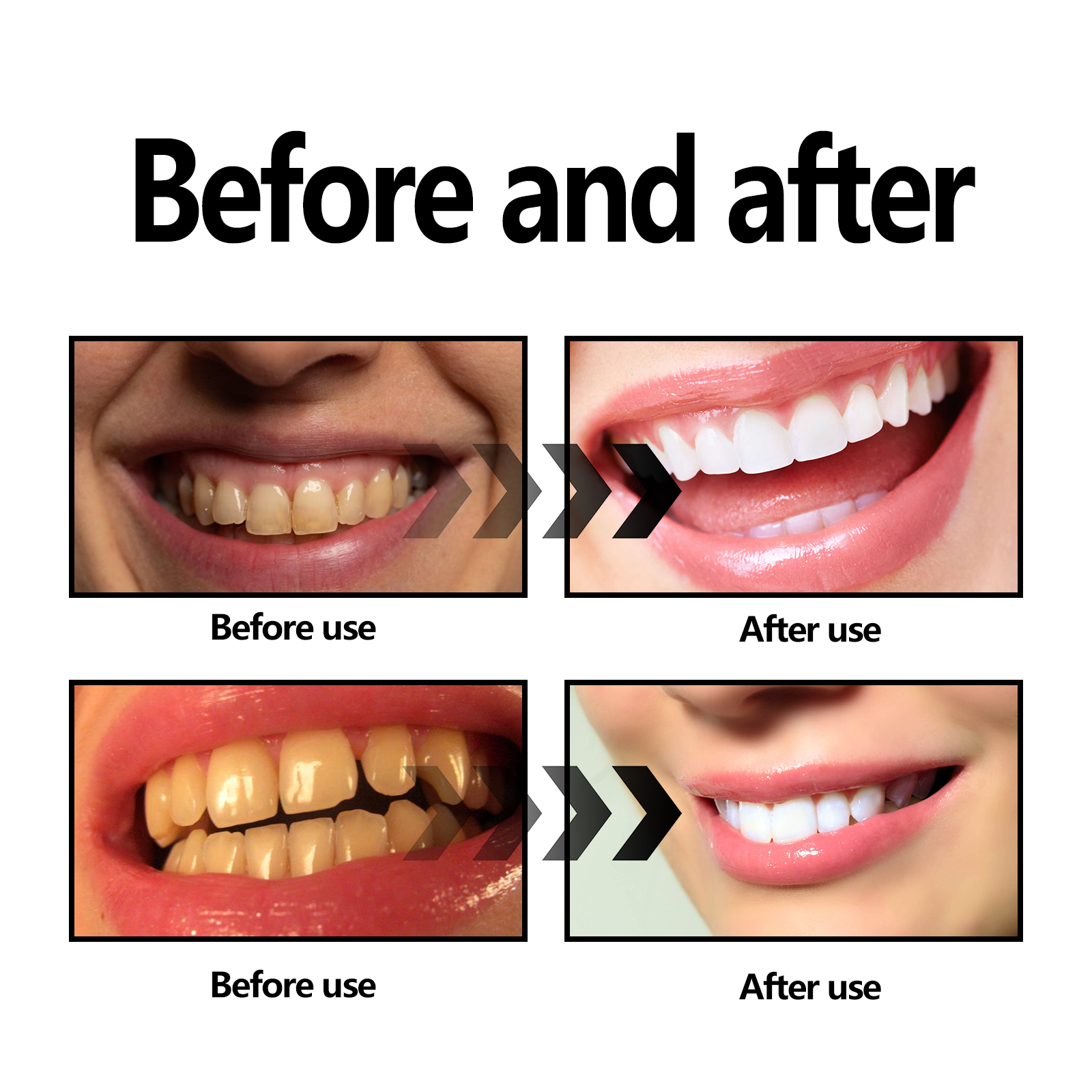 Activated Coconut Charcoal Too - Teeth Whitening Charcoal บทวิจารณ์และราคา