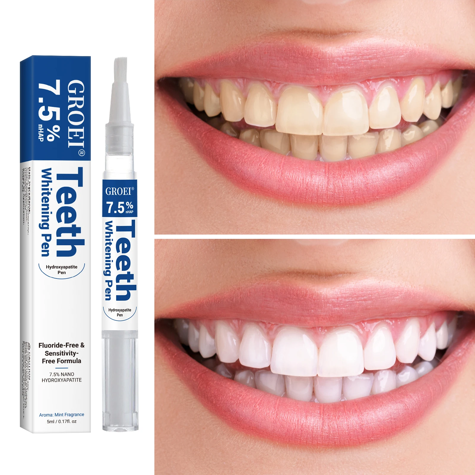 Hydroxyapatite Tooth Whitening - Teeth Whitening Gels Used By Dentists บทวิจารณ์และราคา