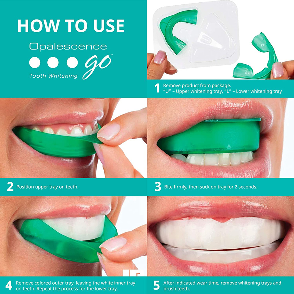 Hydrogen Peroxide For Teeth Wh - Teeth Whitening With Hydrogen Peroxide บทวิจารณ์และราคา