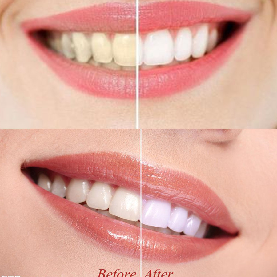 Bamboo Charcoal Teeth Tooth De - Teeth Whitening Charcoal บทวิจารณ์และราคา