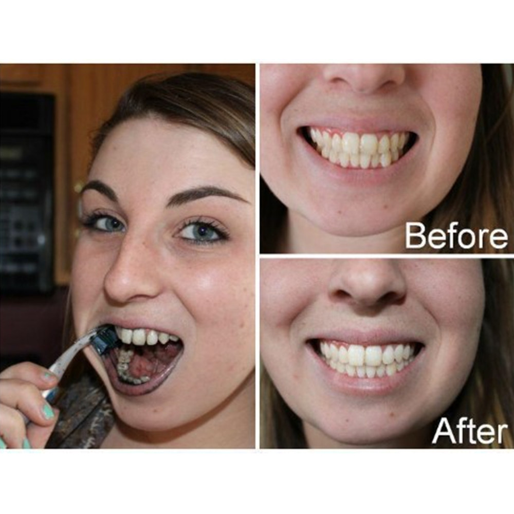 Bamboo Charcoal Teeth Tooth De - Teeth Whitening Charcoal บทวิจารณ์และราคา