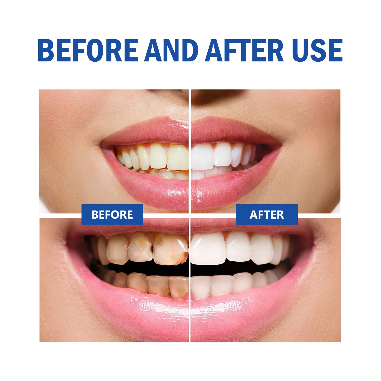 2pcs Gum Repair Gel Spray Deep - Teeth Whitening Xylitol บทวิจารณ์และราคา