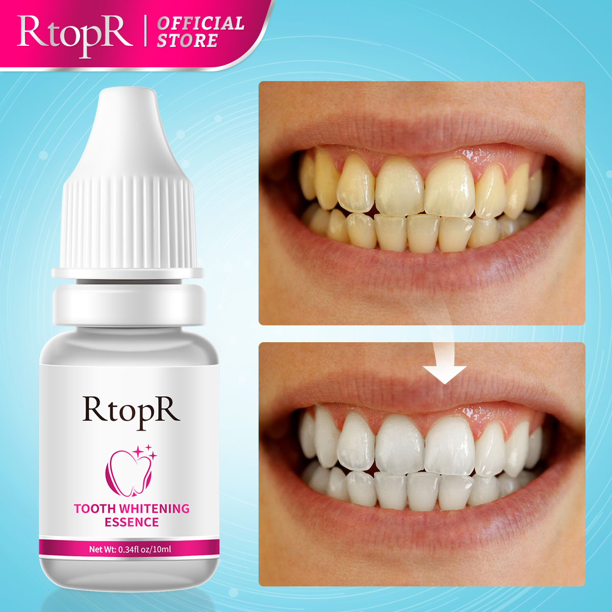 Tooth Whitening Serum Whitenin - Teeth Whitening Xylitol บทวิจารณ์และราคา