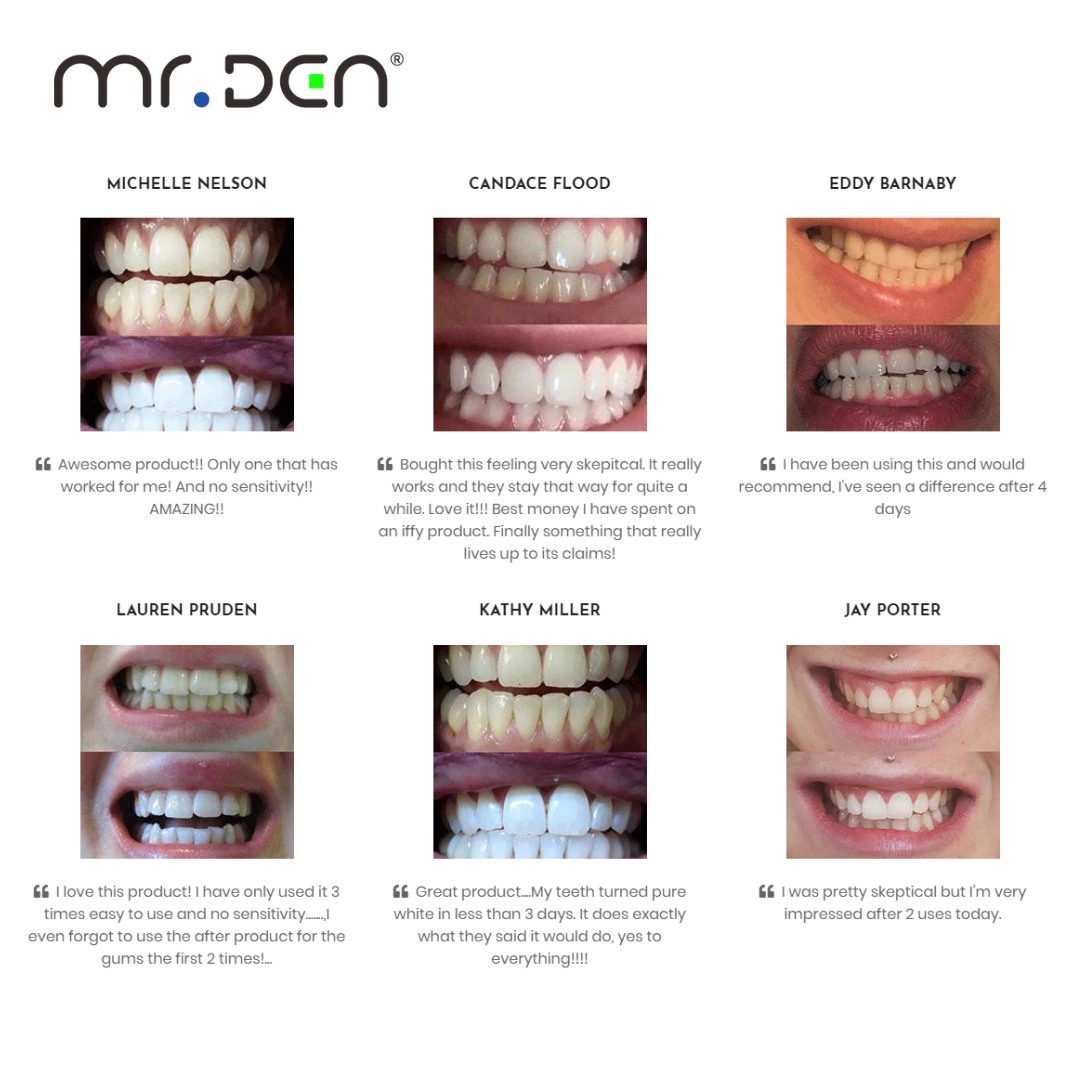 Dr. Whiten 3 Pack Teeth Whiten - Teeth Whitening Gels บทวิจารณ์และราคา