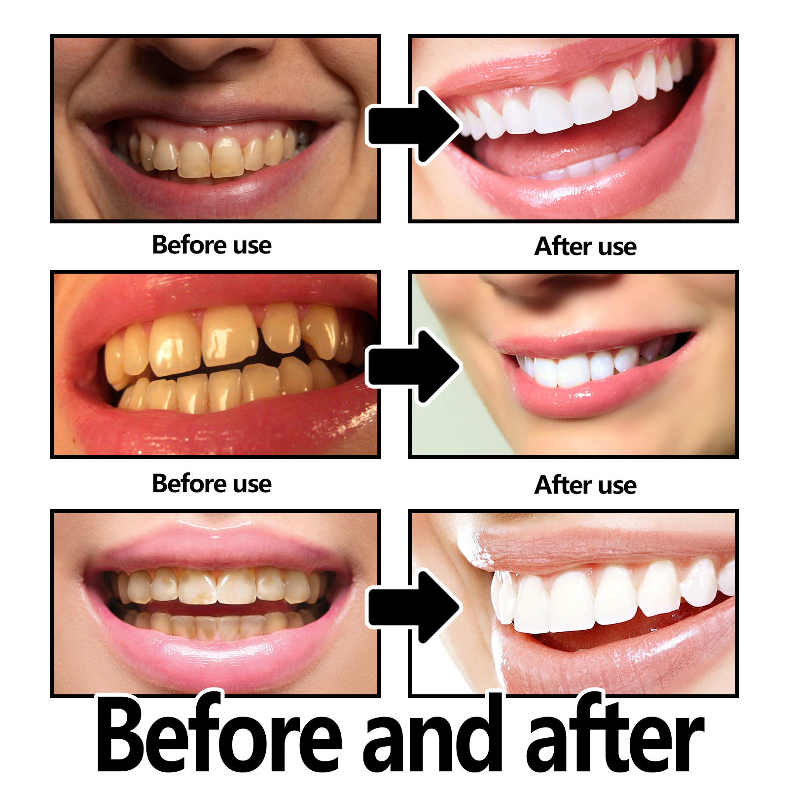 Xylitol Mint Purple Toothpaste - Teeth Whitening Xylitol บทวิจารณ์และราคา