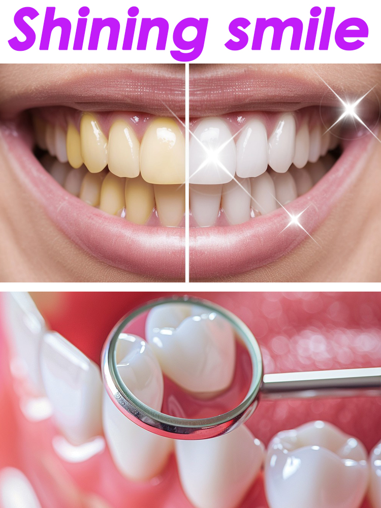 GlorySmile Teeth Whitening Fru - Teeth Whitening Xylitol บทวิจารณ์และราคา