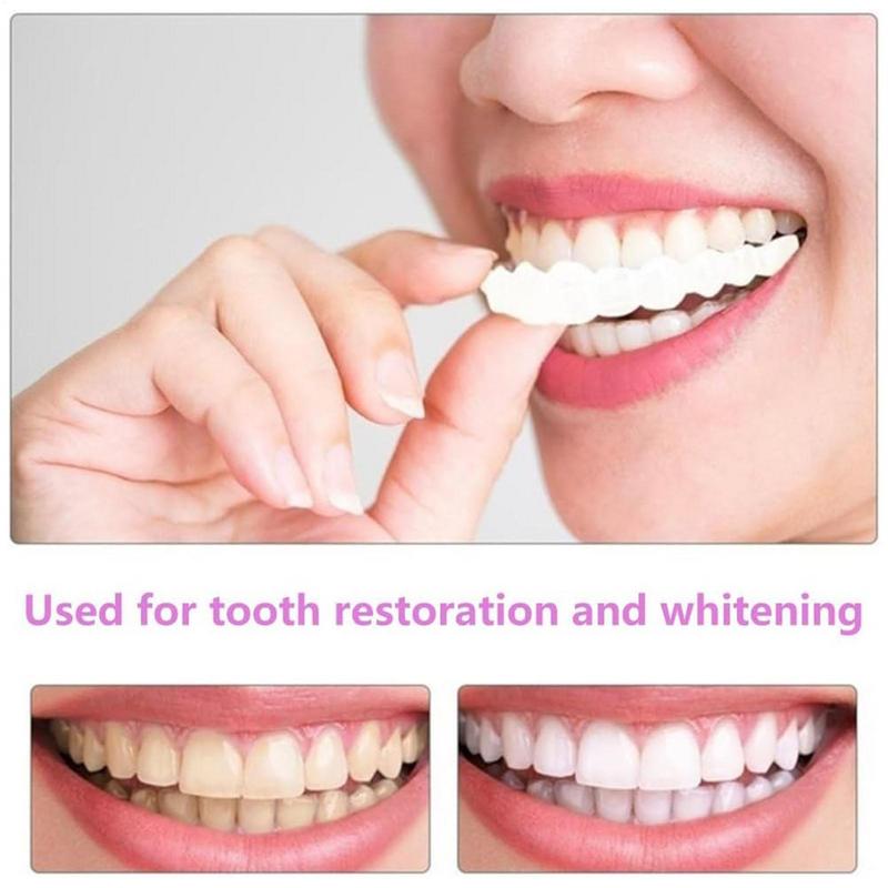 Snap On Teeth Veneers Instant  - Teeth Whitening Instant บทวิจารณ์และราคา