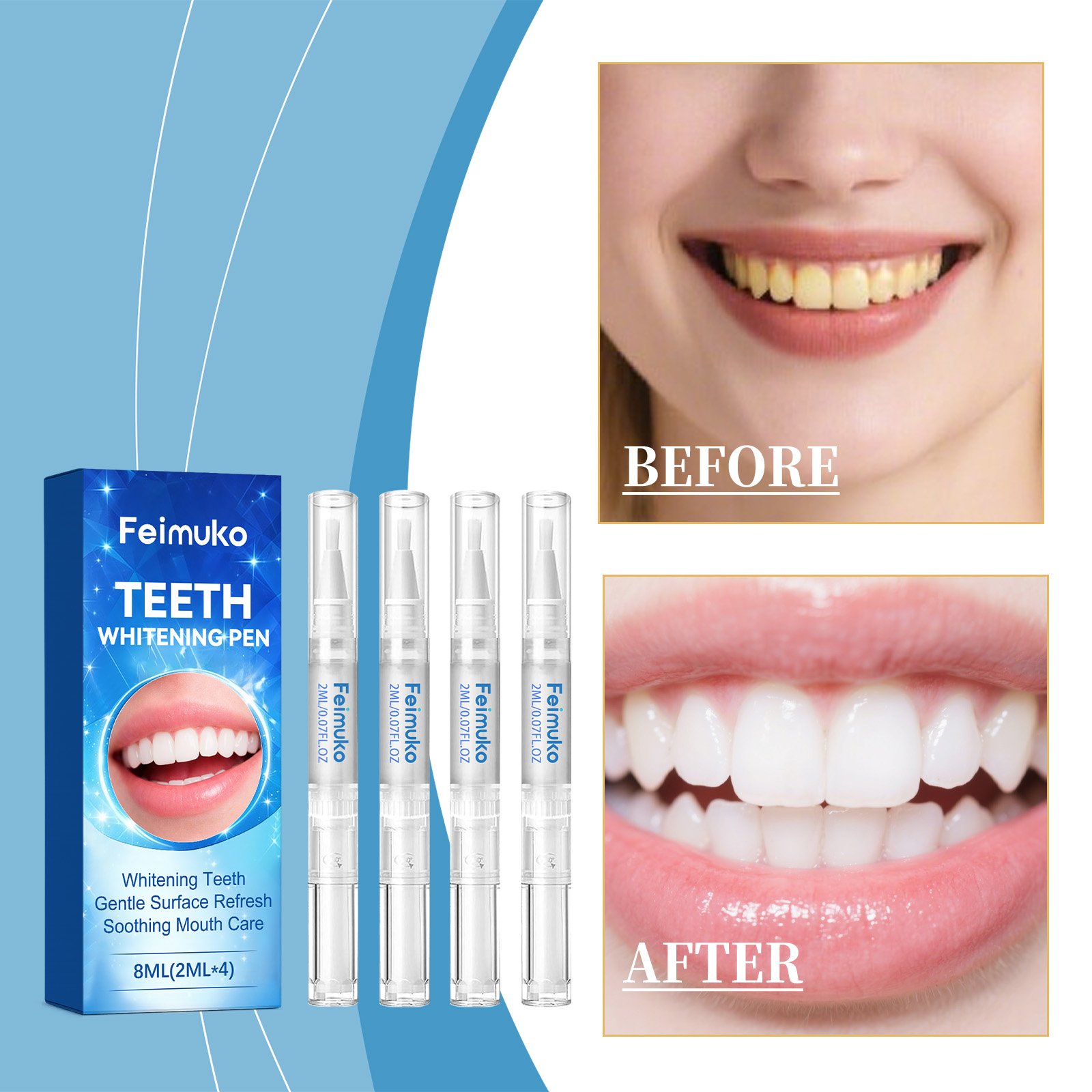 Feimuko 8ml Teeth Gel Pen Gent - Teeth Whitening With Hydrogen Peroxide บทวิจารณ์และราคา