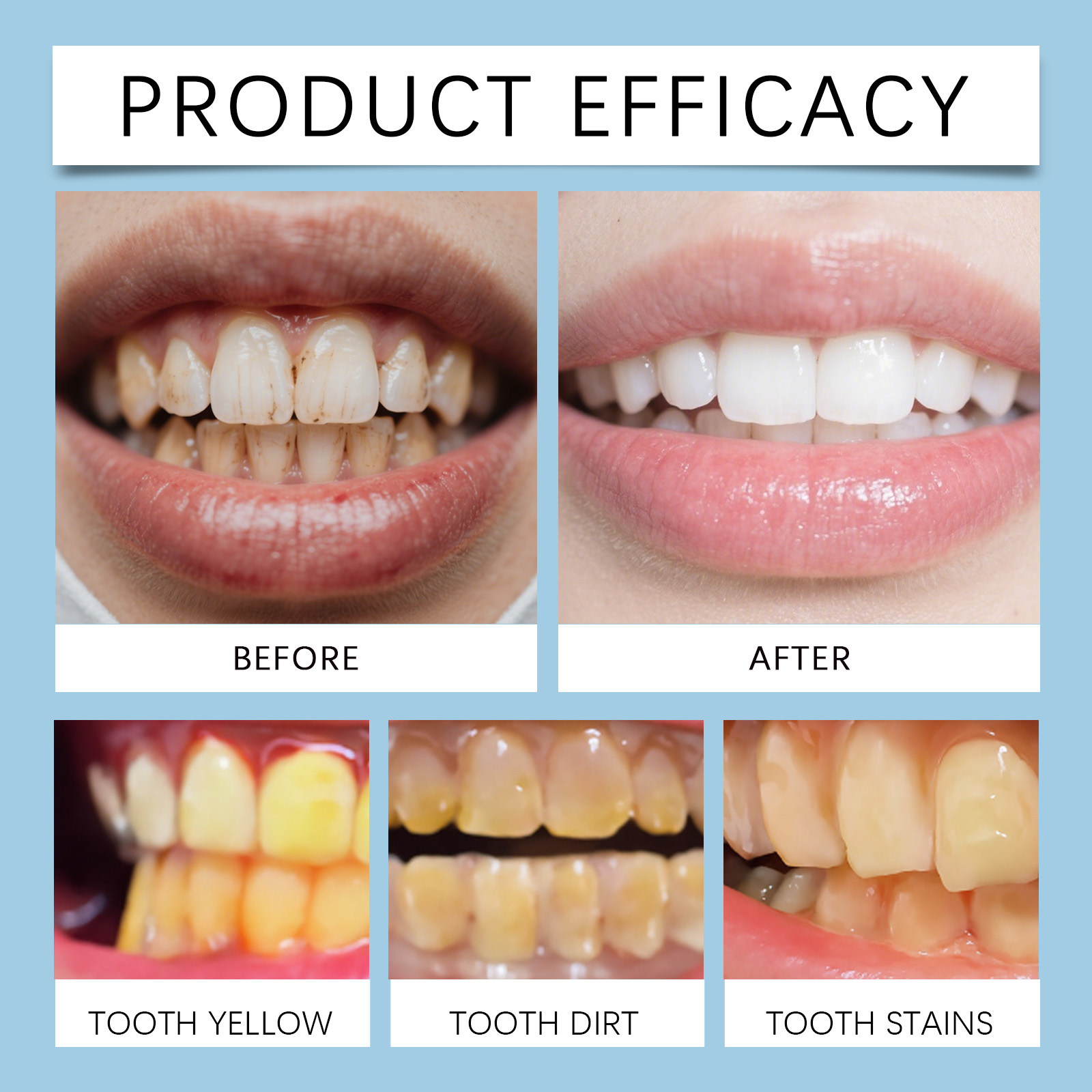 Feimuko 8ml Teeth Gel Pen Gent - Teeth Whitening With Hydrogen Peroxide บทวิจารณ์และราคา