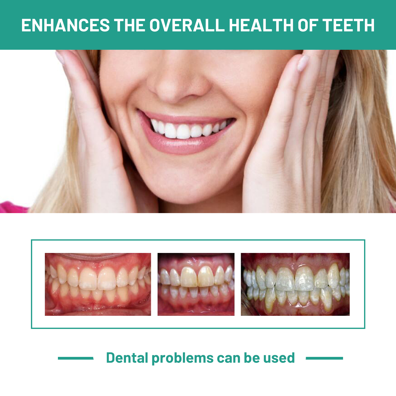 Probiotic Toothpaste Whiten To - Teeth Whitening Xylitol บทวิจารณ์และราคา