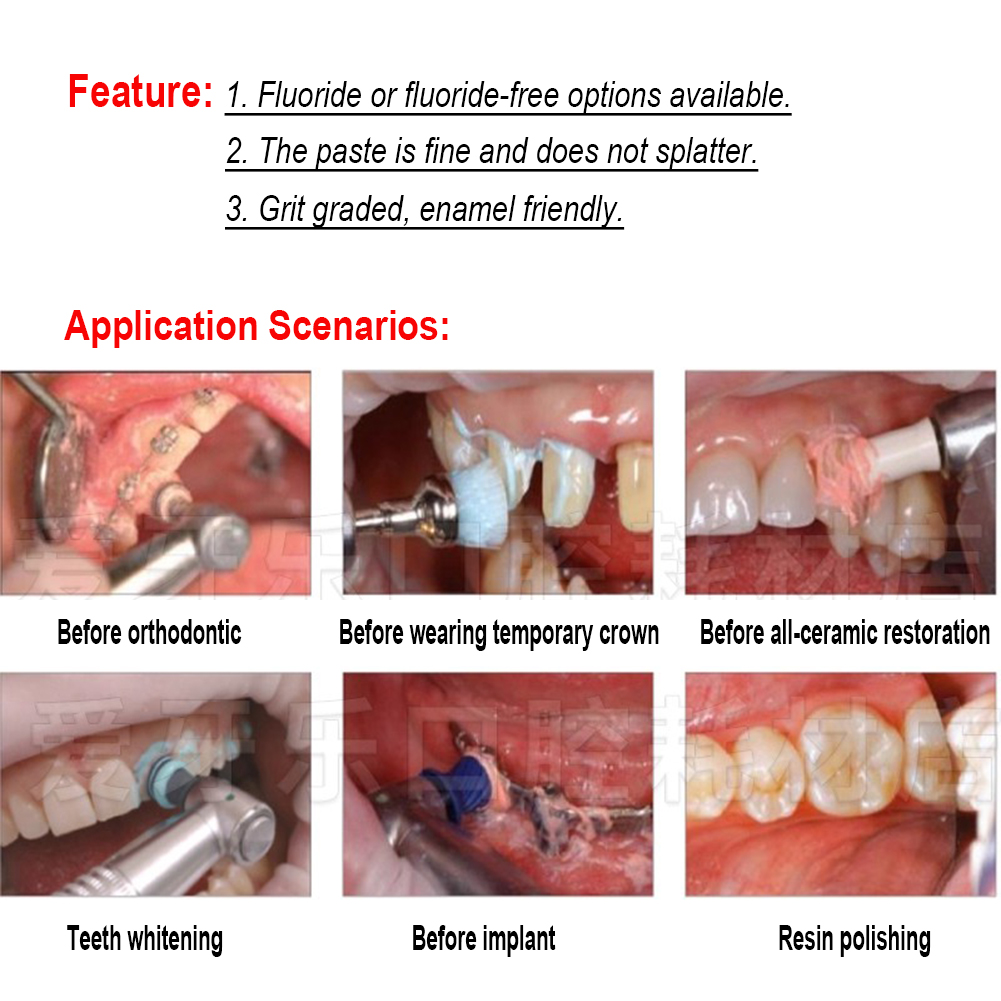 Ivoclar Vivadent Oral Teeth Po - Teeth Whitening Xylitol บทวิจารณ์และราคา
