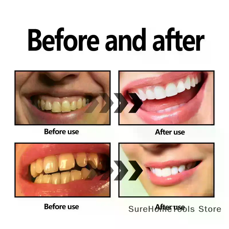 Bamboo Charcoal Powder For Tee - Teeth Whitening Charcoal บทวิจารณ์และราคา