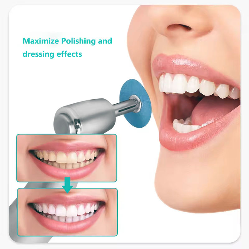 40pcs Dental Polishing Discs H - Teeth Whitening Kit Professional บทวิจารณ์และราคา