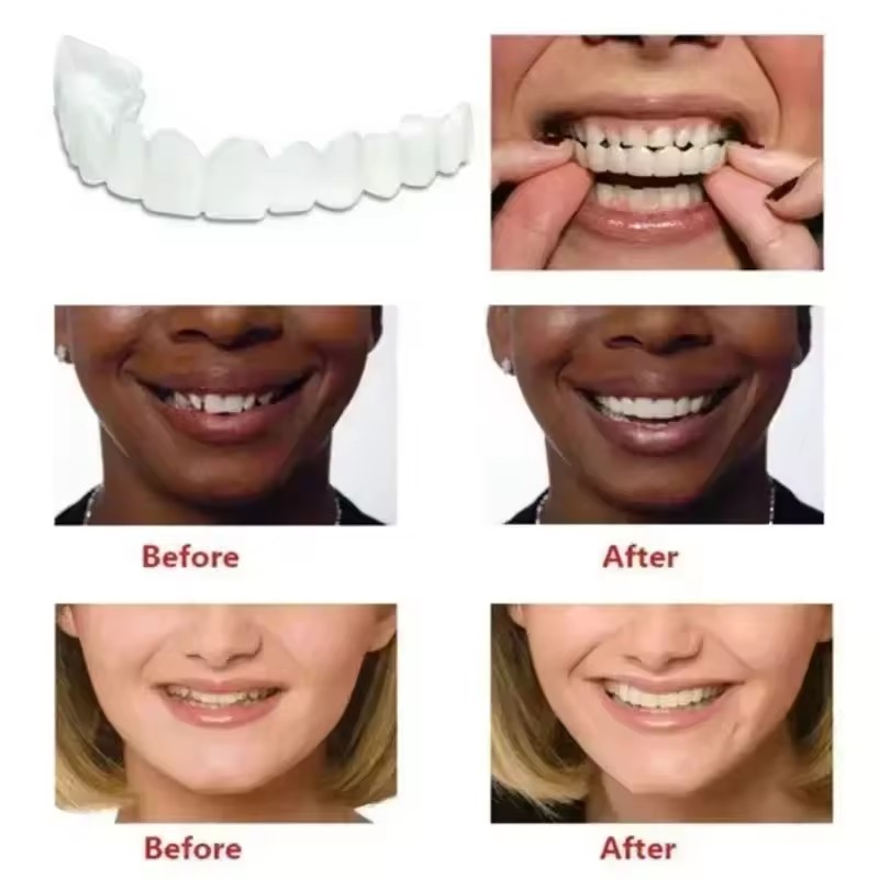 Teeth Veneers Whitening Dentur - Teeth Whitening Kit บทวิจารณ์และราคา
