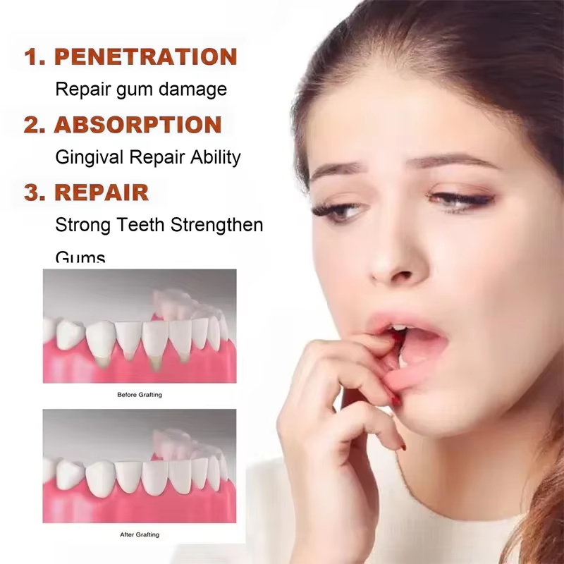 Rapid Repair Gums Serum Effect - Remineralizing Toothpaste บทวิจารณ์และราคา