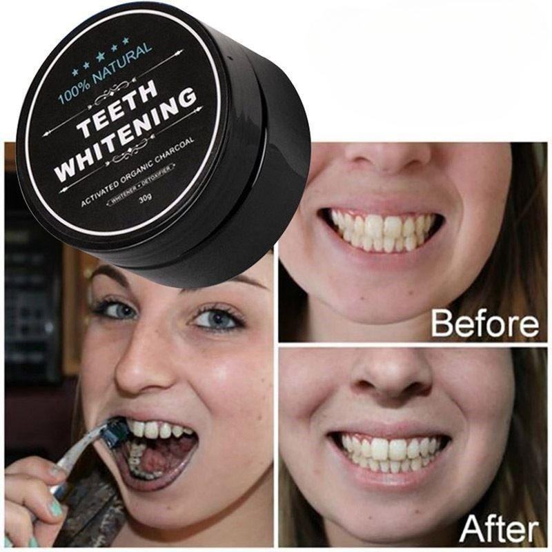 1 Box Activated Charcoal Teeth - Teeth Whitening Charcoal บทวิจารณ์และราคา