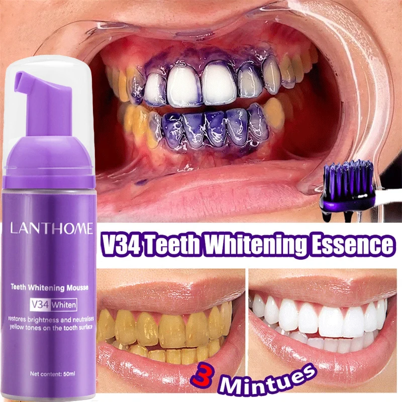 V34 Teeth Whitening Mousse Too - Teeth Whitening Xylitol บทวิจารณ์และราคา