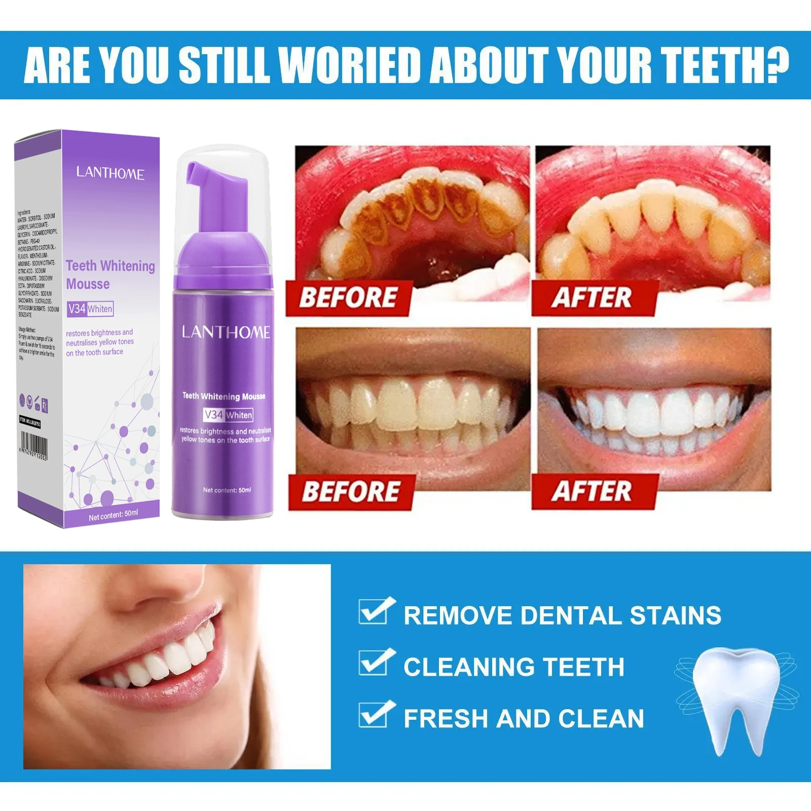 V34 Teeth Whitening Mousse Too - Teeth Whitening Xylitol บทวิจารณ์และราคา