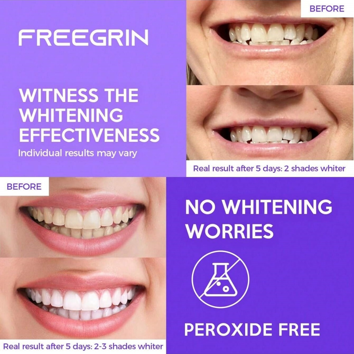 Deluxe Whitening Teeth Sticker - Teeth Whitening With Hydrogen Peroxide บทวิจารณ์และราคา