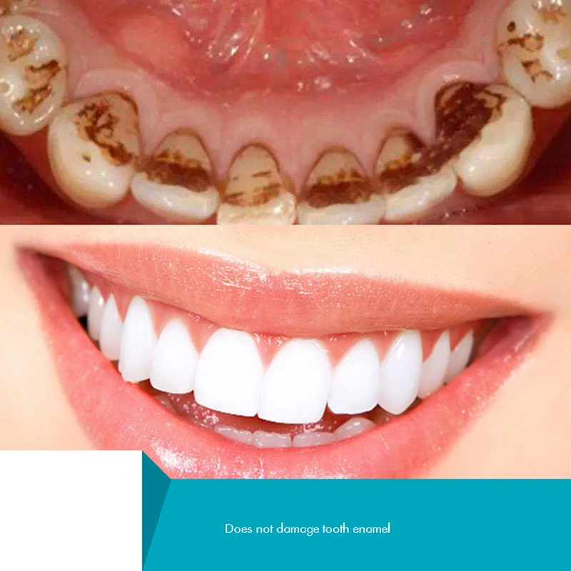 Herbal Tooth Powder, Natural T - Teeth Whitening Xylitol บทวิจารณ์และราคา