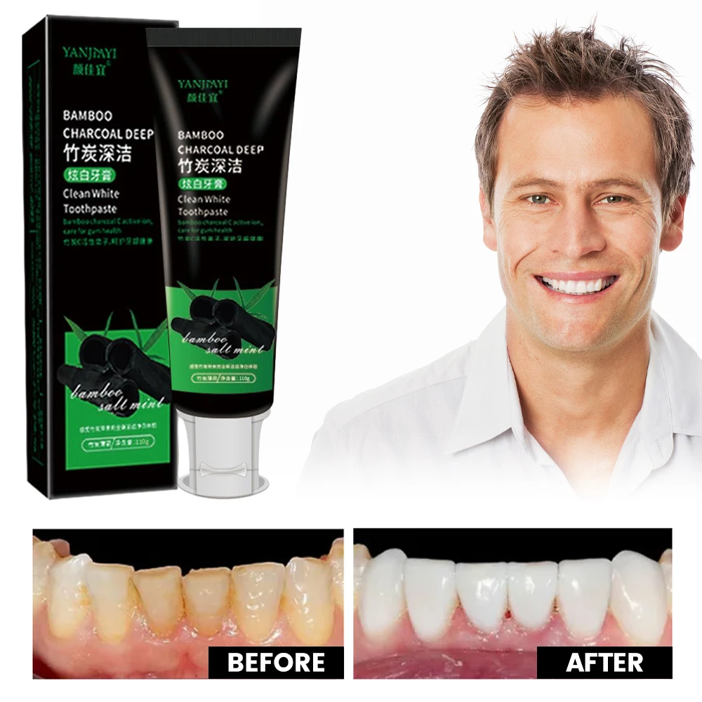 110g Bamboo Charcoal Black Too - Teeth Whitening Charcoal บทวิจารณ์และราคา