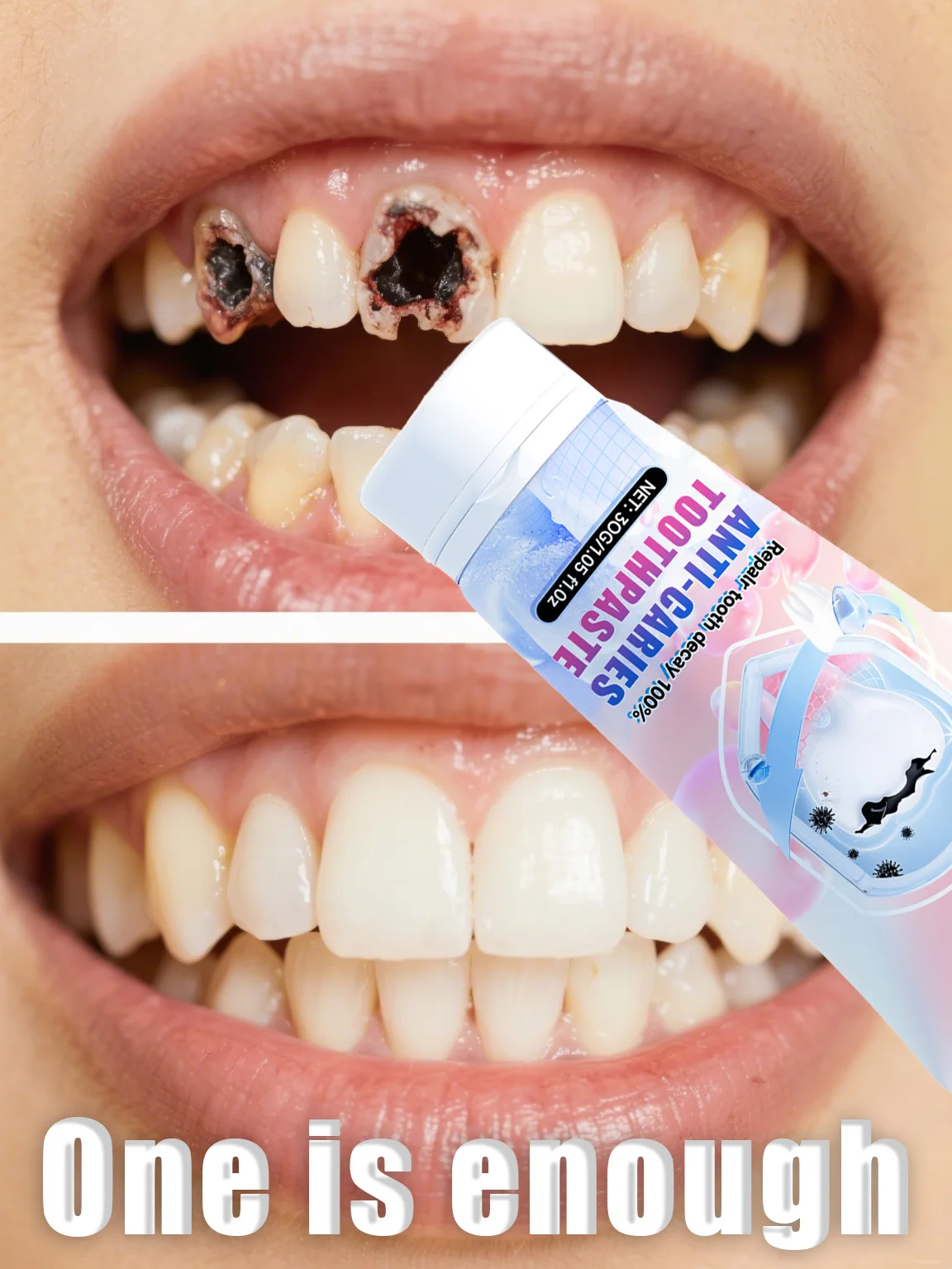 ⁹⁹% ᵒᶠ ᵖᵉᵒᵖˡᵉ ʳᵉᵖᵘʳᶜʰᵃˢᵉ ᵗᵒ ʳᵉ - Remineralizing Toothpaste บทวิจารณ์และราคา