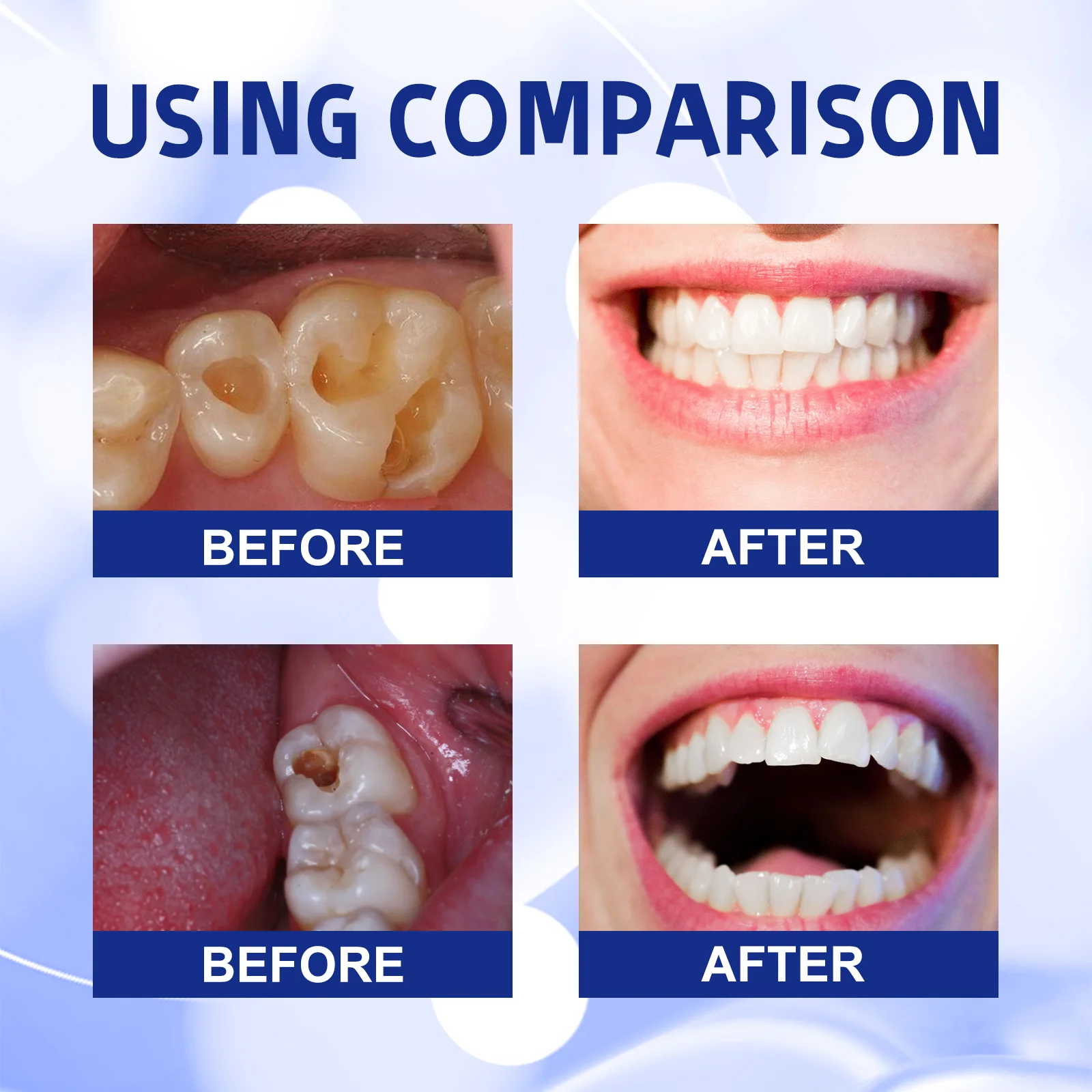 ⁹⁹% ᵒᶠ ᵖᵉᵒᵖˡᵉ ʳᵉᵖᵘʳᶜʰᵃˢᵉ ᵗᵒ ʳᵉ - Remineralizing Toothpaste บทวิจารณ์และราคา