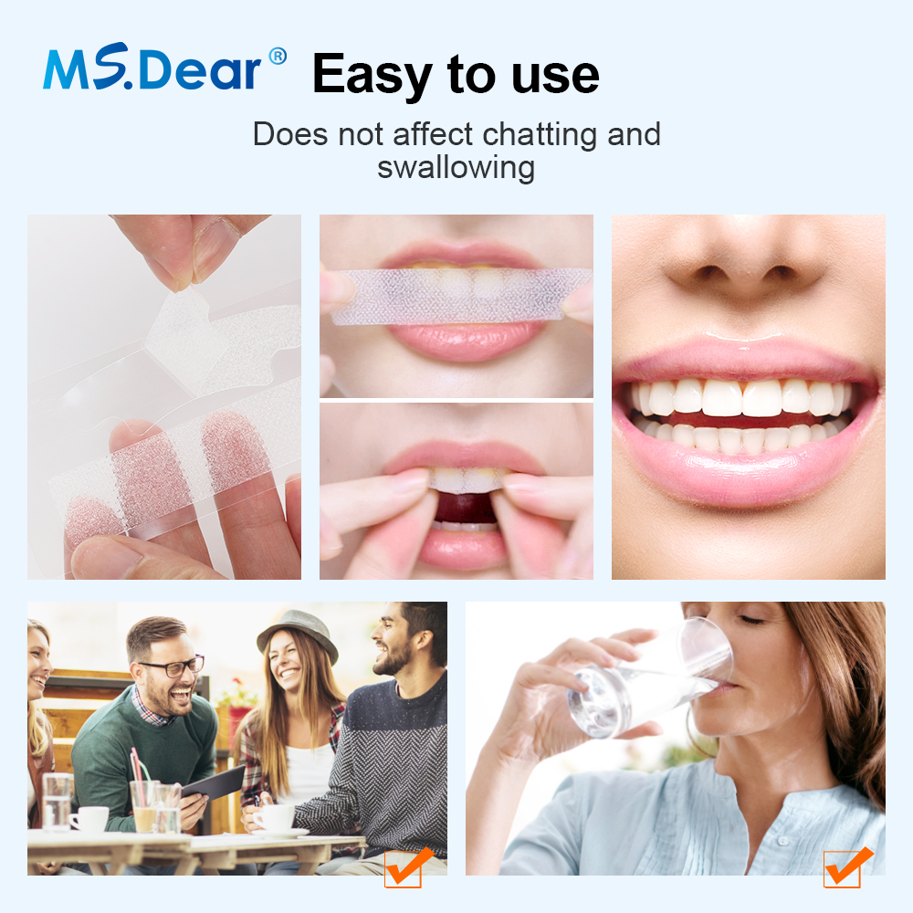 Teeth Whitening Strips Cleansi - Teeth Whitening Gels บทวิจารณ์และราคา